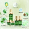 Acne Remover Pimple Treatment Organic Tea Tree Extract Anti-aging Skincare Set OEM Skin Care Products - Image 2