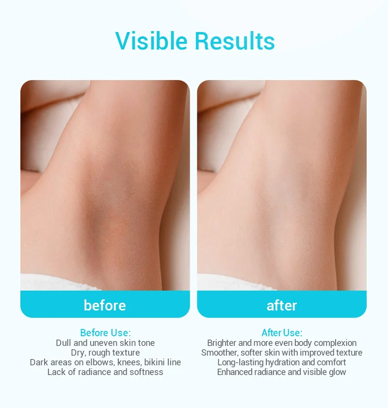 Side-by-side comparison of skin before and after treatment, showing improvement in texture and tone. Left side dull, right side smoother and glowing.
